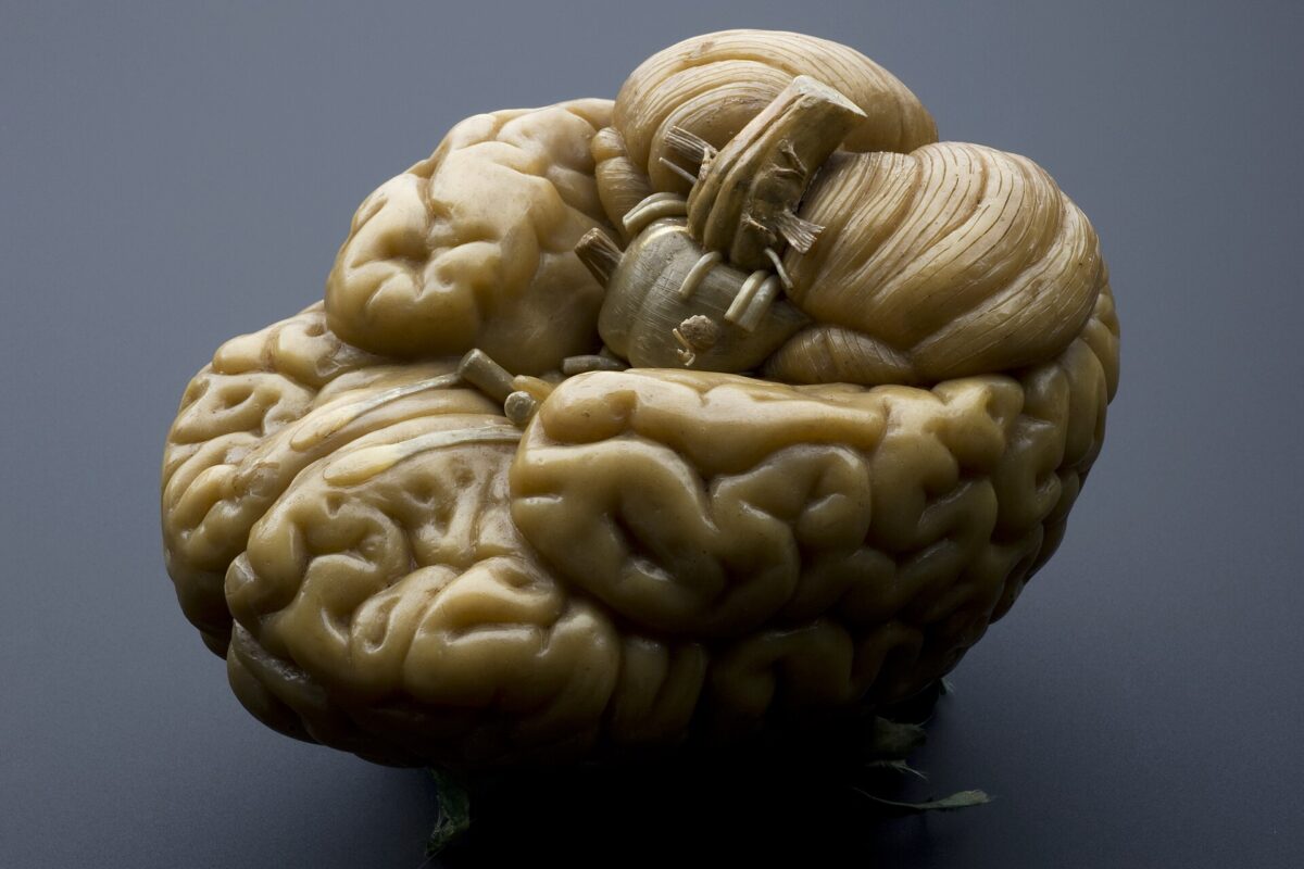 Cerveau gauche ou droit : pourquoi cette étiquette ne dit rien de vous