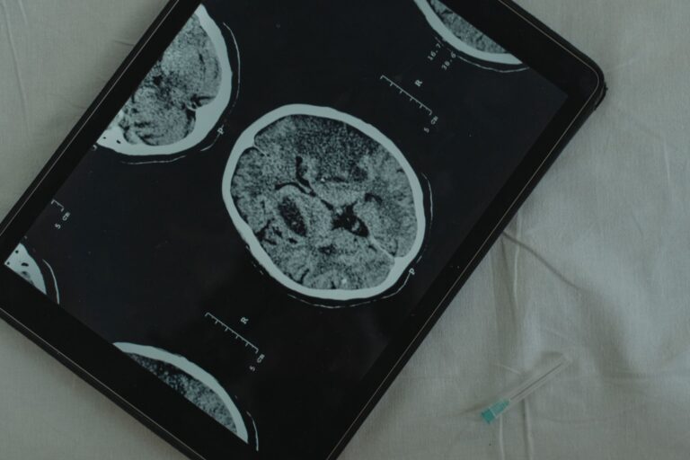 Une étude sur le cerveau d’enfants relie-t-elle vraiment QI et quartier ?